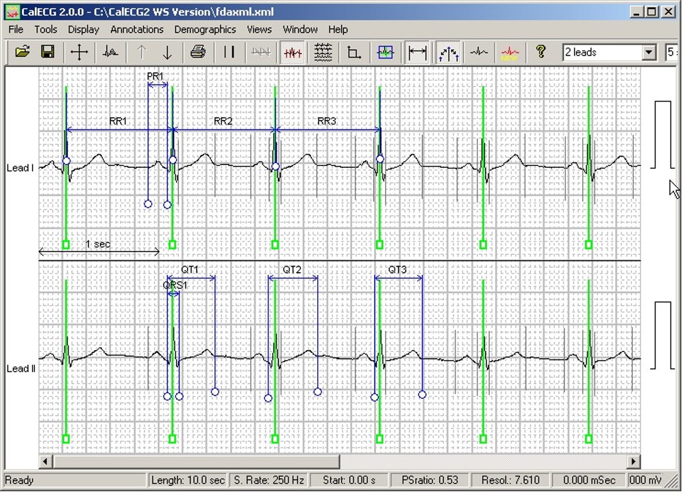 Resting ECGs