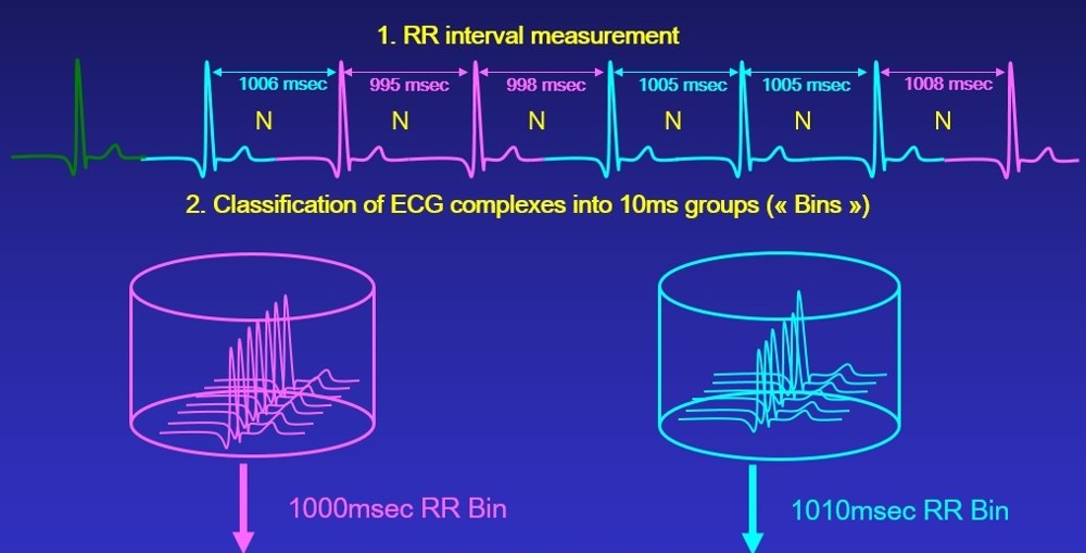 Continuous ECG Recordings