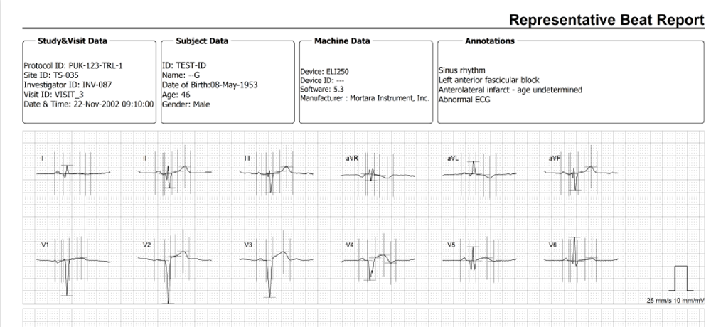 ECGSolve