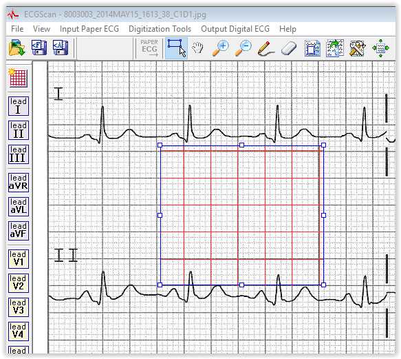 paper ECG to digital