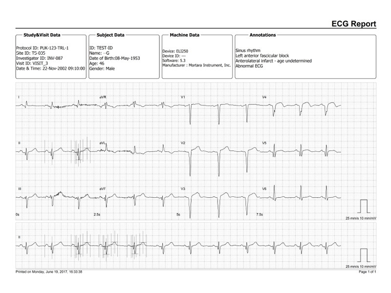 ECGSolve