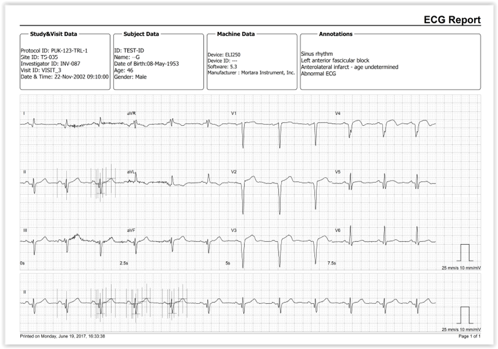 AMPS LLC announces the release of ECGSolve, its new ECG File Processing Software tool