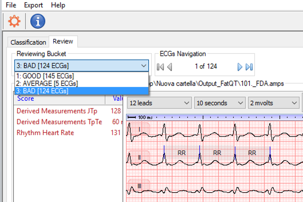 AMPS LLC releases the new version (version 2) of FAT-QT, a tool for fully automated analysis of ECG traces