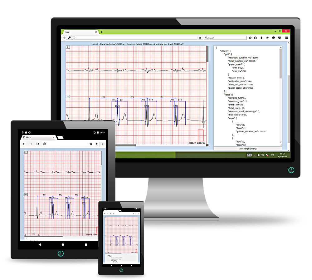 AMPS LLC announces the release of ViewECGWeb, its new online Viewer tool for ECG traces